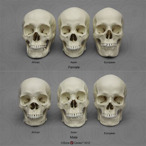 skulls unlimited vs bone clones